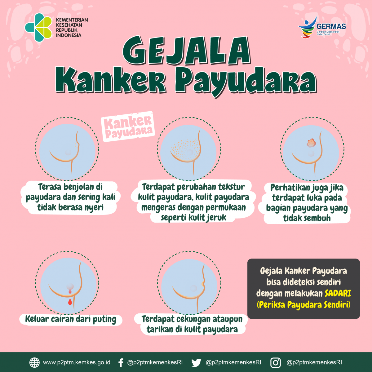MENGENAL KANKER PAYUDARA 